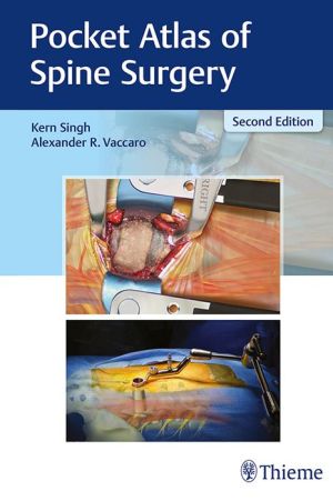 Pocket Atlas of Spine Surgery, 2e - Image 34