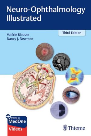Neuro-Ophthalmology Illustrated, 3e - Image 9