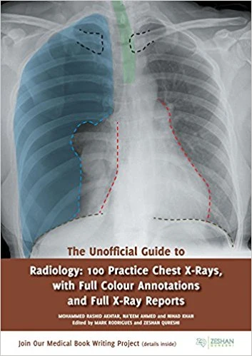 The Unofficial Guide to Radiology: 100 Practice Chest X Rays with Full Colour Annotations and Full X Ray Reports** - Image 18