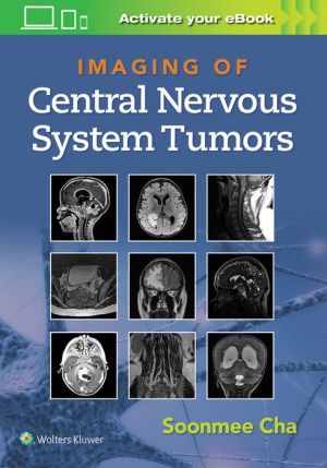 Imaging of CNS Tumors - Image 5