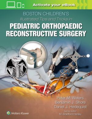 Boston Children's Illustrated Tips and Tricks in Pediatric Orthopaedic Reconstructive Surgery - Image 14