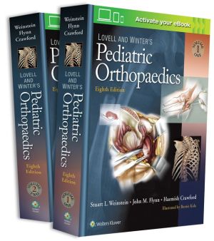 Lovell and Winter's Pediatric Orthopaedics, 2-Volume Set, 8e - Image 23