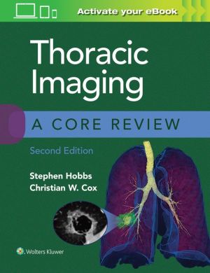 Thoracic Imaging: A Core Review, 2e - Image 5
