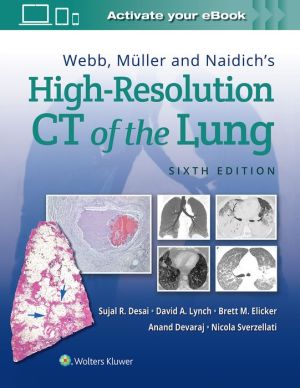 Webb, Müller and Naidich's High-Resolution CT of the Lung, 6e - Image 5