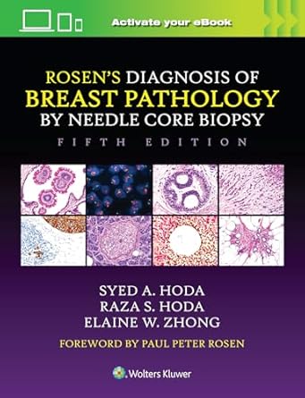 Rosen's Diagnosis of Breast Pathology by Needle Core Biopsy, 5e