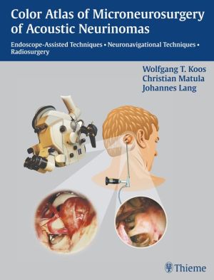Color Atlas of Microsurgery of Acoustic Neurinomas : Endoscope-Assisted Techniques - Neuronavigational Techniques - Radiosurgery** - Image 9