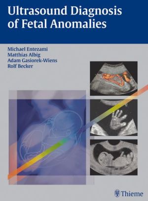 Ultrasound Diagnosis of Fetal Anomalies - Image 21