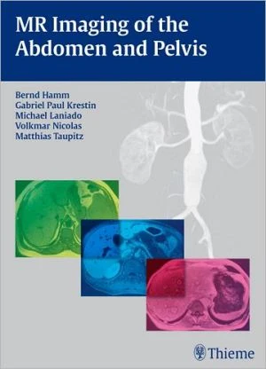 MR Imaging of the Abdomen and Pelvis - Image 48