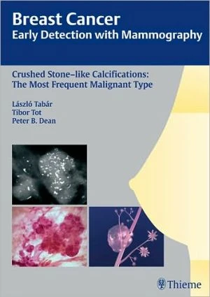 Breast Cancer: Early Detection with Mammography - Image 13