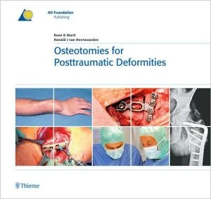 Osteotomies for Posttraumatic Deformities - Image 2