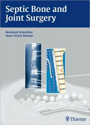Septic Bone and Joint Surgery - Image 2