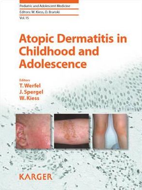 Atopic Dermatitis in Childhood and Adolescence (Pediatric and Adolescent Medicine) - Image 3