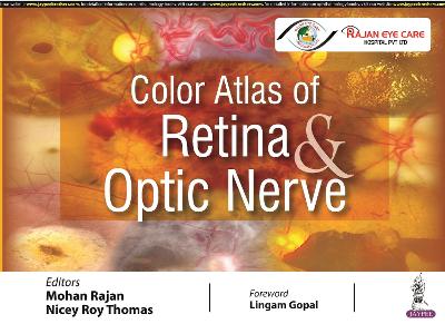 Color Atlas of Retina & Optic Nerve - Image 2
