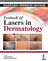 Textbook of Lasers in Dermatology - Image 31