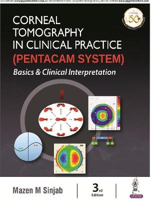 Corneal Tomography in Clinical Practice (Pentacam System) Basics & Clinical Interpretation, 3e** - Image 3