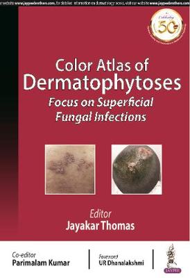 Color Atlas of Dermatophytoses: Focus on Superficial Fungal Infections - Image 2