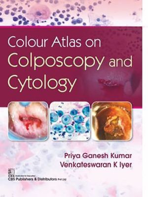 Colour Atlas on Colposcopy and Cytology (HB) - Image 22