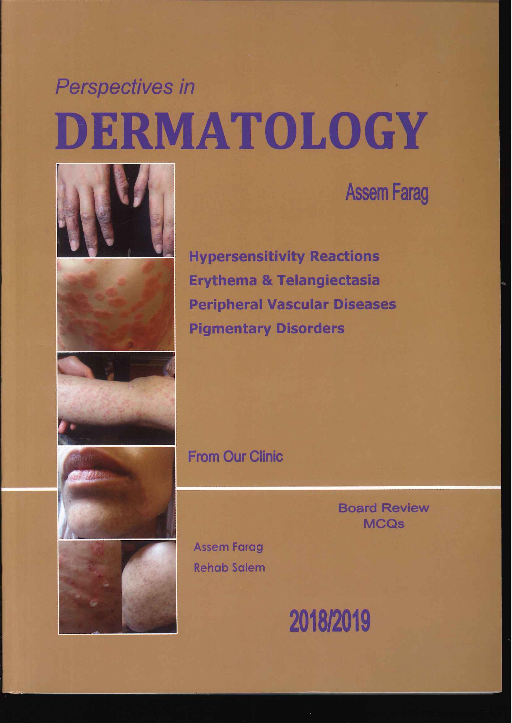 Perspectives in Dermatology: Hypersensitivity Reactions Erythema & Telangiectasia Peripheral Vascular Diseases Pigmentary Disorders - Image 10