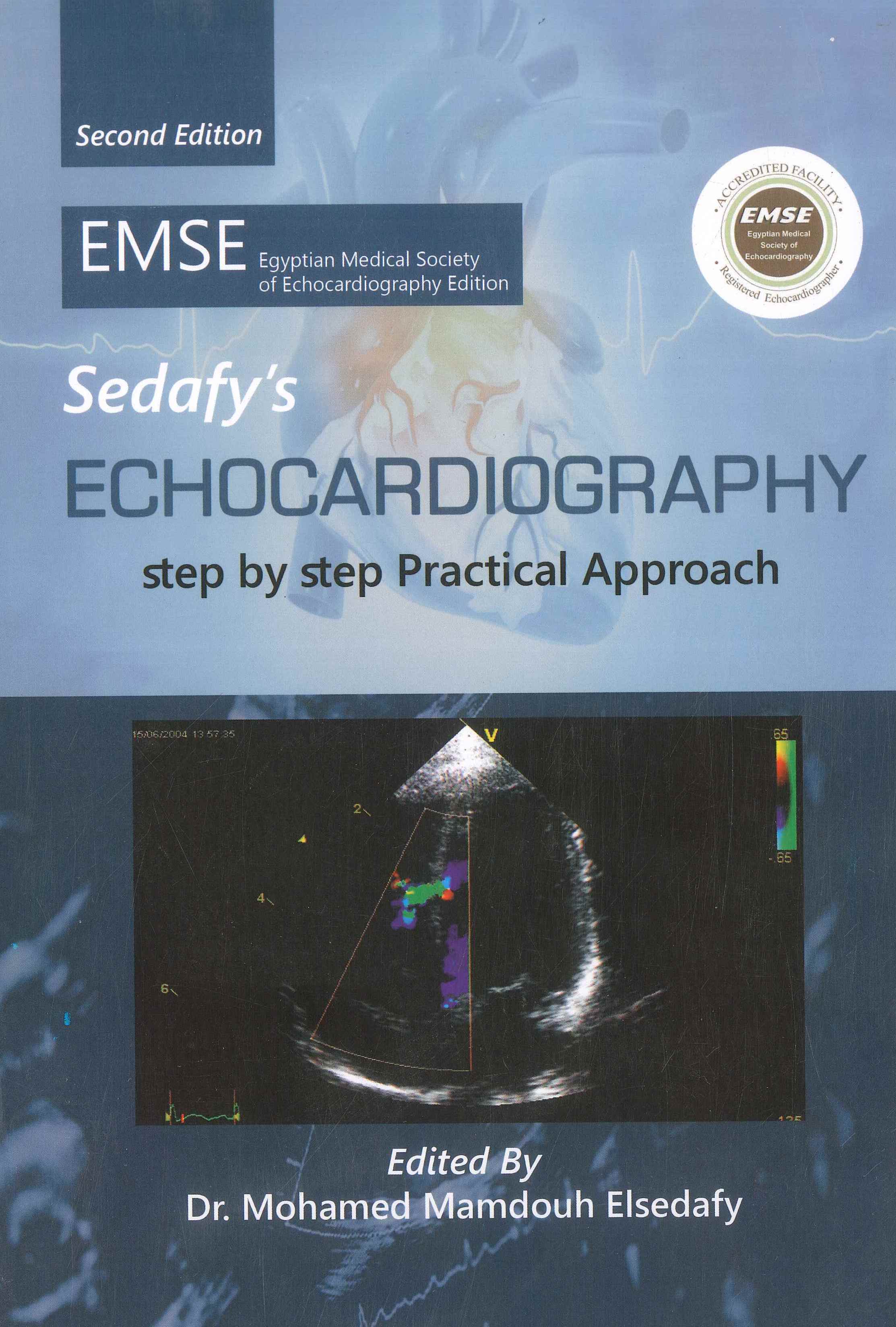 Sedafy‘S Echocardiography: Step by Step Practical Approach, 2e